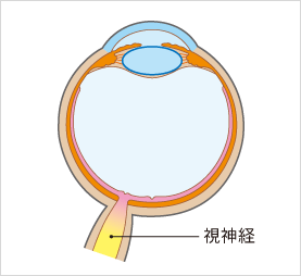 緑内障