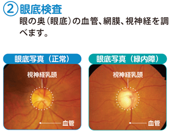 眼底検査